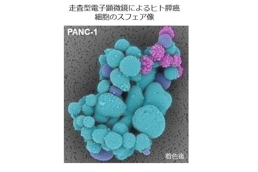 膵臓がん研究(がん幹細胞研究、がんの上皮間葉転換研究)高齢者がん研究グループ